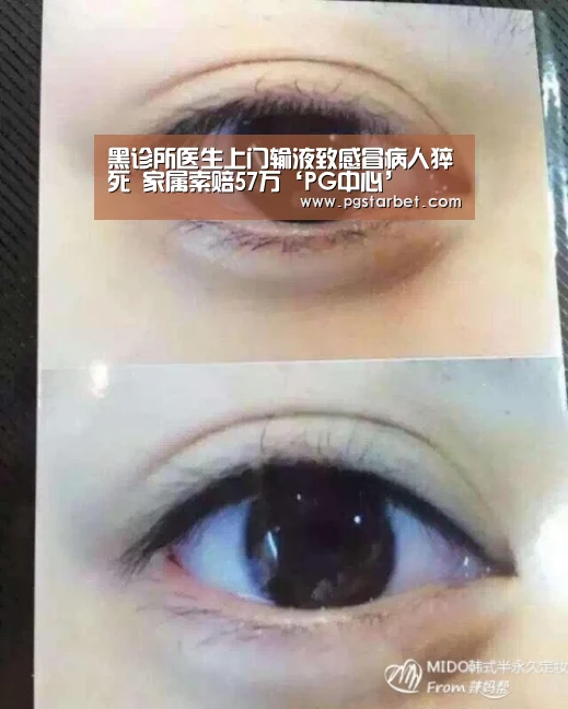 黑诊所医生上门输液致感冒病人猝死 家属索赔57万‘PG中心’(图1) PG中心